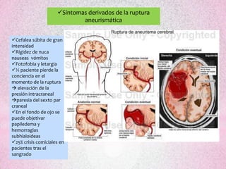 Síntomas derivados de la ruptura
                             aneurismática


Cefalea súbita de gran
intensidad
Rigidez de nuca
nauseas vómitos
Fotofobia y letargia
½ paciente pierde la
conciencia en el
momento de la ruptura
 elevación de la
presión intracraneal
paresia del sexto par
craneal
En el fondo de ojo se
puede objetivar
papiledema y
hemorragias
subhialoideas
25% crisis comiciales en
pacientes tras el
sangrado
 