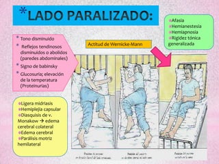 *                                                     Afasia
                                                       Hemianestesia
                                                       Hemiapnosia
* Tono disminuido                                      Rigidez tónica
                           Actitud de Wernicke-Mann   generalizada
* Reflejos tendinosos
  disminuidos o abolidos
  (paredes abdominales)
* Signo de babinsky
* Glucosuria; elevación
  de la temperatura
  (Proteinurias)


 Ligera midriasis
 Hemiplejia capsular
 Diasquisis de v.
Monakow  edema
cerebral colateral
 Edema cerebral
 Parálisis motriz
hemilateral
 