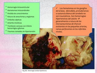 *   Hemorragia intraventricular
                                          Los hematomas en los ganglios
*   Hematomas intracerebrales            de la base, diencéfalo, protuberancia
*   Perdida de conocimientos             o sustancia blanca del cerebelo no
*   Rotura de aneurismas y angiomas      son traumáticos. Son hemorragias
*   Embolias sépticas
                                         hipertensivas del adulto 
                                         generalmente a rotura de los
*   Arteritis micóticas
                                         microaneurismas de Charcot
*   Trombosis venosas con infarto        existentes en las pequeñas arterias,
    hemorrágico gliomas                  ramas perforantes en los referidos
*   Traumas craneales sin hipertensión   niveles.
 