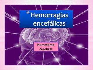 Hematoma
 cerebral
 
