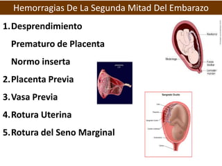 Hemorragias De La Segunda Mitad Del Embarazo
1.Desprendimiento
 Prematuro de Placenta
 Normo inserta
2.Placenta Previa
3.V...