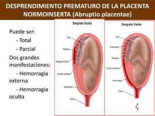 DESPRENDIMIENTO PREMATURO DE LA PLACENTA
      NORMOINSERTA (Abruptio placentae)
                FISIOPATOLOGIA
• El DPPNI...