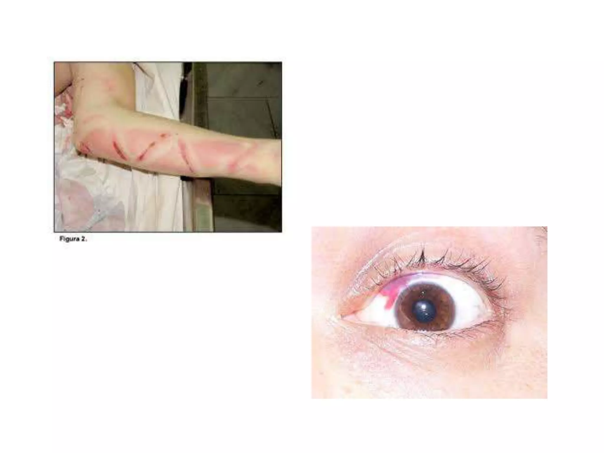 Hemorragiasinternas 111107205727-phpapp01