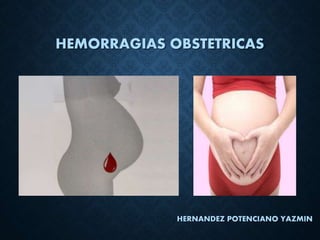 HEMORRAGIAS OBSTETRICAS
HERNANDEZ POTENCIANO YAZMIN
 
