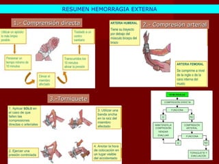 1.- Comprensión directa 2.- Compresión arterial 3.-Torniquete RESUMEN HEMORRAGIA EXTERNA 