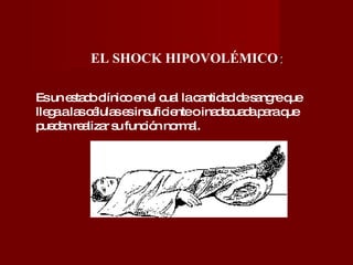 EL SHOCK HIPOVOLÉMICO :  Es un estado clínico en el cual la cantidad de sangre que llega a las células es insuficiente o inadecuada para que puedan realizar su función normal. 