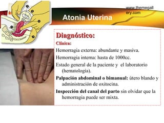 www.themegall
ery.comLOGO
Diagnóstico:Diagnóstico:
Clínica:Clínica:
Hemorragia externa: abundante y masiva.
Hemorragia int...