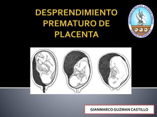 GIANMARCO GUZMAN CASTILLO 
 