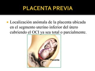  Localización anómala de la placenta ubicada 
en el segmento uterino inferior del útero 
cubriendo el OCI ya sea total o parcialmente. 
 