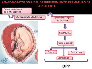 Entre la placenta y la decidua Derrama la sangre 
extravasada 
HEMATOMA 
Gana Expansión 
Diseca 
Compresión 
Destrucción 
Rotura espontanea 
de la Art. Espirales 
 