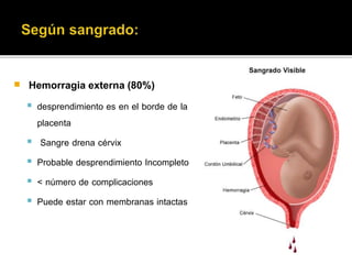 Hemorragia externa (80%) 
 desprendimiento es en el borde de la 
placenta 
 Sangre drena cérvix 
 Probable desprendimiento Incompleto 
 < número de complicaciones 
 Puede estar con membranas intactas 
 