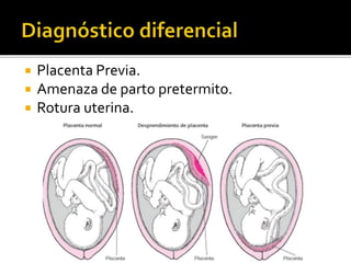  Placenta Previa. 
 Amenaza de parto pretermito. 
 Rotura uterina. 
 
