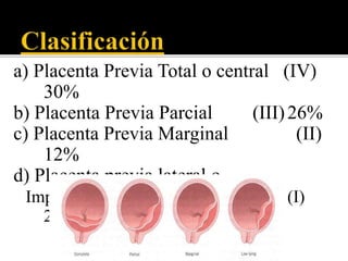 a) Placenta Previa Total o central (IV) 
30% 
b) Placenta Previa Parcial (III)26% 
c) Placenta Previa Marginal (II) 
12% 
d) Placenta previa lateral o 
Implantanción baja (I) 
23% 
 