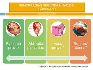 HEMORRAGIAS SEGUNDA MITAD DEL
EMBARAZO
Obstetricia de alto riesgo, Rodrigo Cifuentes 6ta edición
Placenta
previa
Abruptio
...