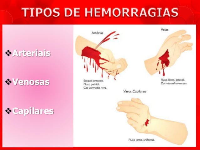 Hemorragias