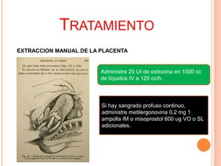 TRATAMIENTO
EXTRACCION MANUAL DE LA PLACENTA

Administre 20 UI de oxitocina en 1000 cc
de líquidos IV a 125 cc/h.

Si hay sangrado profuso continuo,
administre metilergonovina 0,2 mg 1
ampolla IM o misoprostol 600 ug VO o SL
adicionales.

 