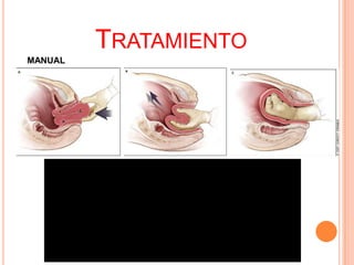 TRATAMIENTO
MANUAL

 