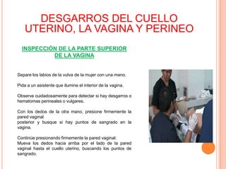 DESGARROS DEL CUELLO
UTERINO, LA VAGINA Y PERINEO
INSPECCIÓN DE LA PARTE SUPERIOR
DE LA VAGINA

Separe los labios de la vulva de la mujer con una mano.
Pida a un asistente que ilumine el interior de la vagina.
Observe cuidadosamente para detectar si hay desgarros o
hematomas perineales o vulgares.
Con los dedos de la otra mano, presione firmemente la
pared vaginal
posterior y busque si hay puntos de sangrado en la
vagina.
Continúe presionando firmemente la pared vaginal:
Mueva los dedos hacia arriba por el lado de la pared
vaginal hasta el cuello uterino, buscando los puntos de
sangrado.

 