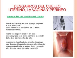 DESGARROS DEL CUELLO
UTERINO, LA VAGINA Y PERINEO
INSPECCIÓN DEL CUELLO DEL UTERO

Inserte una pinza de aro o de esponjas y fíjela en
el labio anterior del
cuello uterino en la posición de las 12 de las
manecillas del reloj.

Inserte una segunda pinza de aro o de
esponjas y fíjela en el cuello uterino en la posición
de las 3 de las manecillas del reloj.
Inspeccione el cuello uterino entre las dos pinzas
para detectar si hay puntos de sangrado, utilizando
una gasa para limpiar la sangre, de ser necesario,
a fin de poder hacer una mejor inspección.

 