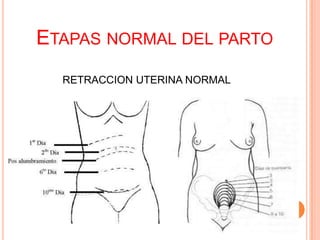 ETAPAS NORMAL DEL PARTO
RETRACCION UTERINA NORMAL

 