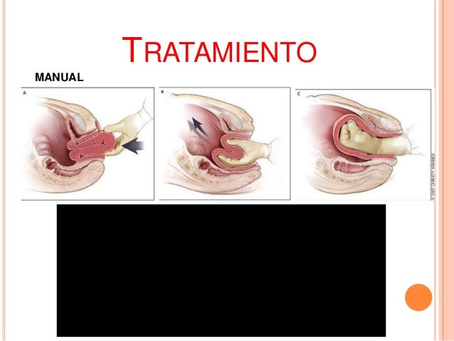 El ungüento a la eccema eplan