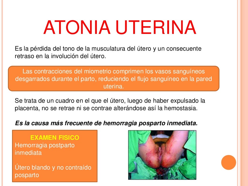 Hemorragia Tercera etapa del parto Hemorragia Tercera etapa del parto