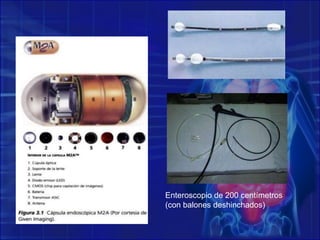 ATLAS OF GASTROENTEROLOGY DIAGNOSIS 4th Edition, Edited by Tadataka Yamada© 2009 Blackwell Publishing