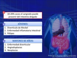 *10-20% casos el sangrado puede provenir del intestino delgado*JÓVENES:Divertículo de MeckelEnfermedad inflamatoria intestinalPólipos *MAYORES 60 AÑOS:Enfermedad diverticularAngiodisplasiasNeoplasiasRemes Troche, Ramos de la Medina , Roesch-DietlenGASTROENTEROLOGÍA CLÍNICA 2ª edición