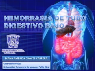 HEMORRAGIA DE TUBO DIGESTIVO BAJO DIANA AMÉRICA CHÁVEZ CABRERA Gastroenterología Universidad Autónoma de Veracruz “Villa Rica 