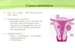 Causas anatómicas Son  la  causa  más frecuente en esta edad. Leiomiomas uterinos:  - Desregulación de un numero de factores del crecimiento que regulan la angiogenesis en un útero en que están presentes los leiomiomas DIAGNOSTICO: - Útero  aumentado  de tamaño irregularmente - USG pélvica  
