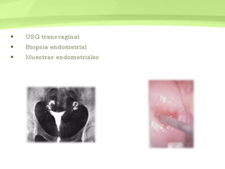 USG transvaginal Biopsia endometrial Muestras endometriales  