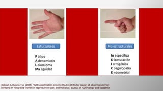 Malcom G Munro et al (2011) FIGO Classification system (PALM-COEIN) for causes of abnormal uterine
bleeding in nongravid women of reproductive age, international journal of Gynecology and obstatrics
 