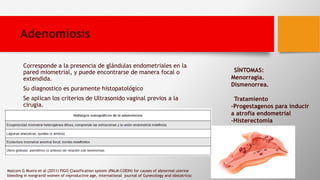 Adenomiosis
Corresponde a la presencia de glándulas endometriales en la
pared miometrial, y puede encontrarse de manera focal o
extendida.
Su diagnostico es puramente histopatológico
Se aplican los criterios de Ultrasonido vaginal previos a la
cirugía.
SÍNTOMAS:
Menorragia.
Dismenorrea.
Tratamiento
-Progestagenos para inducir
a atrofia endometrial
-Histerectomia
Malcom G Munro et al (2011) FIGO Classification system (PALM-COEIN) for causes of abnormal uterine
bleeding in nongravid women of reproductive age, international journal of Gynecology and obstatricsc
 