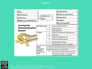 Figure 2 
Fertility and Sterility 2011 95, 2204-2208.e3DOI: (10.1016/j.fertnstert.2011.03.079) 
Copyright © 2011 American Society for Reproductive Medicine Terms and Conditions
 