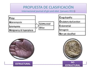 PROPUESTA DE CLASIFICACIÓN
Internacional journal of gin and obst (january 2011)
ESTRUCTURAL
NO
ESTRUCTURAL
 