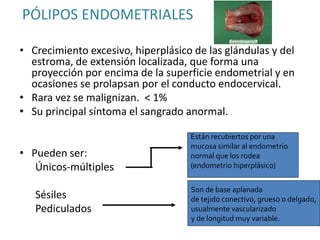 PÓLIPOS ENDOMETRIALES
• Crecimiento excesivo, hiperplásico de las glándulas y del
estroma, de extensión localizada, que forma una
proyección por encima de la superficie endometrial y en
ocasiones se prolapsan por el conducto endocervical.
• Rara vez se malignizan. < 1%
• Su principal síntoma el sangrado anormal.
• Pueden ser:
Únicos-múltiples
Sésiles
Pediculados
Están recubiertos por una
mucosa similar al endometrio
normal que los rodea
(endometrio hiperplásico)
Son de base aplanada
de tejido conectivo, grueso o delgado,
usualmente vascularizado
y de longitud muy variable.
 