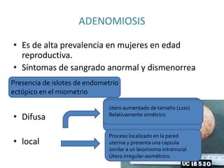 ADENOMIOSIS
• Es de alta prevalencia en mujeres en edad
reproductiva.
• Síntomas de sangrado anormal y dismenorrea
• Difusa
• local
Presencia de islotes de endometrio
ectópico en el miometrio
Afecta las paredes del útero en grado
diverso, difuso y puede estar
localizado, pero no encapsulado.
útero aumentado de tamaño (12ss)
Relativamente simétrico
Proceso localizado en la pared
uterina y presenta una capsula
similar a un leiomioma intramural
Útero irregular-asimétrico.
 
