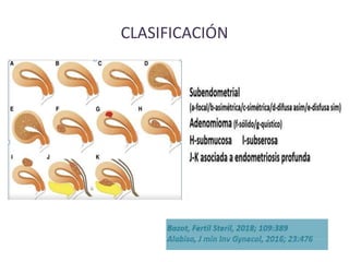 CLASIFICACIÓN
 