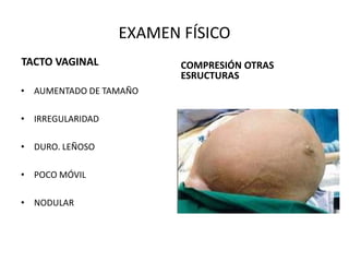 EXAMEN FÍSICO
TACTO VAGINAL
• AUMENTADO DE TAMAÑO
• IRREGULARIDAD
• DURO. LEÑOSO
• POCO MÓVIL
• NODULAR
COMPRESIÓN OTRAS
ESRUCTURAS
 