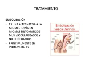 TRATAMIENTO
EMBOLIZACIÓN
• ES UNA ALTERNATIVA A LA
MIOMECTOMÍA EN
MIOMAS SINTOMÁTICOS
MUY VASCULARIZADOS Y
NO PEDICULADOS.
• PRINCIPALMENTE EN
INTRAMURALES
 
