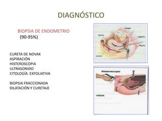 DIAGNÓSTICO
BIOPSIA DE ENDOMETRIO
(90-95%)
CURETA DE NOVAK
ASPIRACIÓN
HISTEROSCOPIA
ULTRASONIDO
CITOLOGÍA EXFOLIATIVA
BIOPSIA FRACCIONADA
DILATACIÓN Y CURETAJE
 