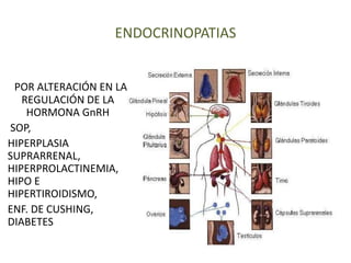 ENDOCRINOPATIAS
POR ALTERACIÓN EN LA
REGULACIÓN DE LA
HORMONA GnRH
SOP,
HIPERPLASIA
SUPRARRENAL,
HIPERPROLACTINEMIA,
HIPO E
HIPERTIROIDISMO,
ENF. DE CUSHING,
DIABETES
 