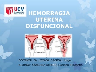 HEMORRAGIA
UTERINA
DISFUNCIONAL
DOCENTE: Dr. LOZADA CACEDA, Jorge.
ALUMNA: SÁNCHEZ ALFARO, Carmen Elizabeth.
 
