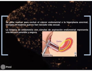 Hemorragia uterina disfuncional