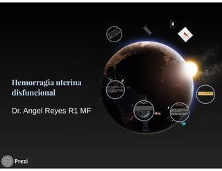 Hemorragia uterina disfuncional