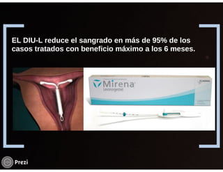 Hemorragia uterina disfuncional