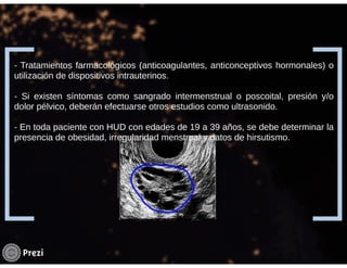 Hemorragia uterina disfuncional