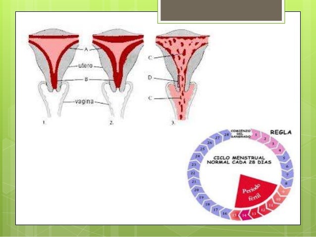 Hemorragia uterina disfuncional