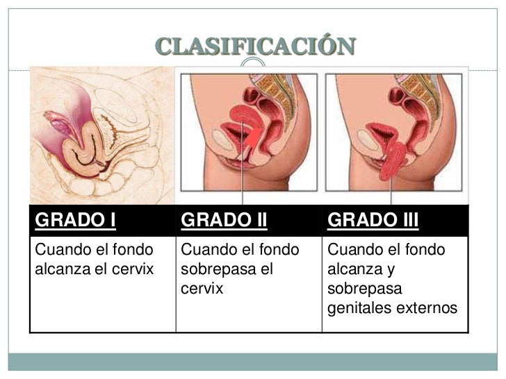 La osteocondrosis del pie las rodillas