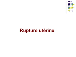 Rupture utérine
 